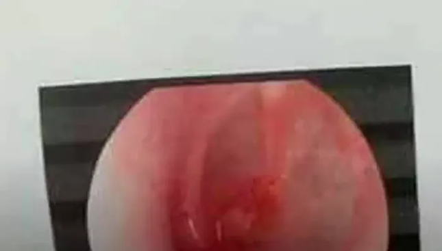 Đình chỉ công tác thầy giáo tát học sinh rách màng nhĩ vì dùng điện thoại trong giờ học ảnh 2